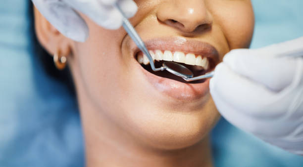 Best After-Hours Emergency Dentist in Elk Plain, WA