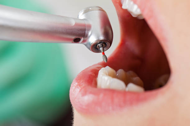Best Pediatric Emergency Dentist in Elk Plain, WA